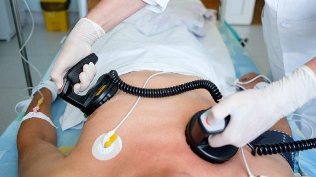Cardioversion électrique : comment ça se passe ?